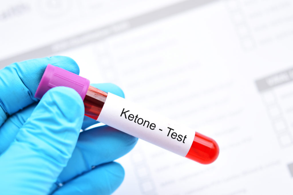 Worried About Ketones: 10 Signs You're in Ketosis